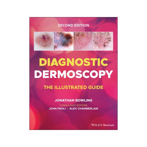 ダーモスコピーのすべて 第二版= TEXTBOOK OF DERMOSCOPY Diagnostic Dermoscopy: The Illustrated Guide, 2nd Edition