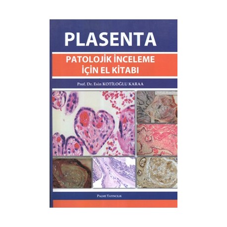 Plasenta Patolojik İnceleme İçin El Kitabı