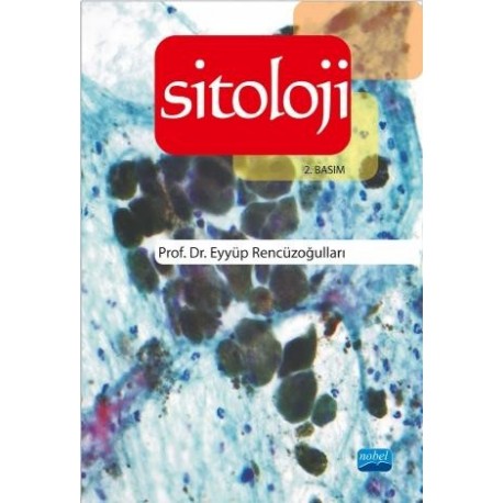 Sitoloji