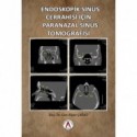 Endoskopik Sinüs Cerrahisi İçin Paranazal Sinüs Tomografisi