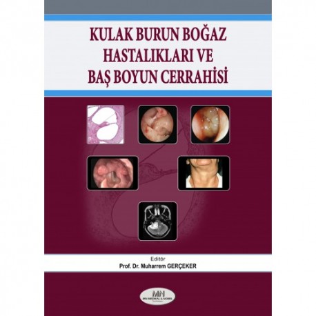 Kulak Burun Boğaz Hastalıkları Baş ve Boyun Cerrahisi