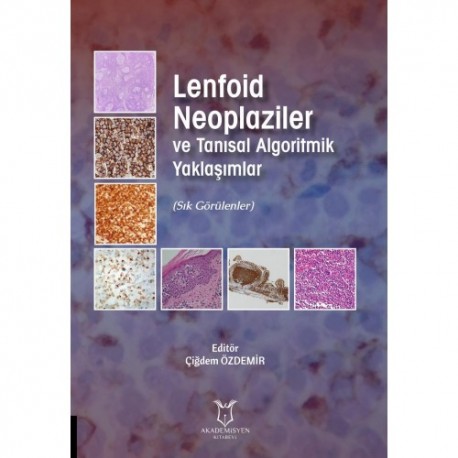 Lenfoid Neoplaziler ve Tanısal Algoritmik Yaklaşımlar Lenfoid Neoplaziler ve Tanısal Algoritmik Yaklaşımlar