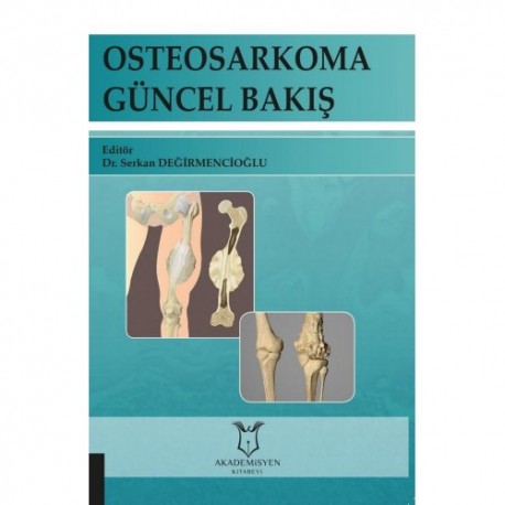 Osteosarkoma Güncel Bakış