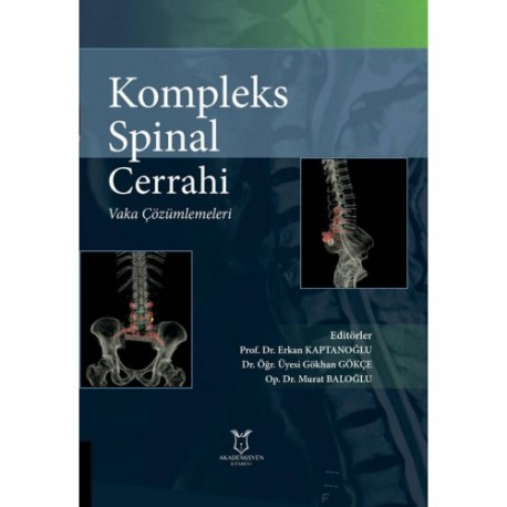 Kompleks Spinal Cerrahi: Vaka Çözümlemeleri Kompleks Spinal Cerrahi: Vaka Çözümlemeleri