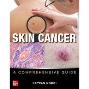 Skin Cancer: A Comprehensive Guide