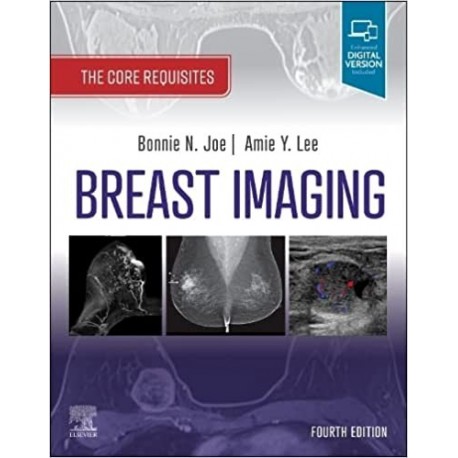 Breast Imaging: The Core Requisites 4th Edition