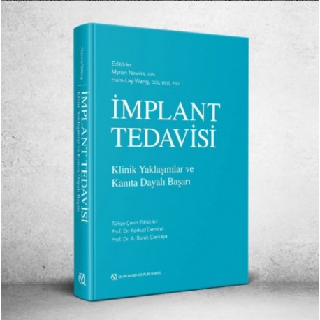 İmplant Tedavisi Klinik Yaklaşımlar ve Kanıta Dayalı Başarı