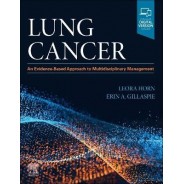 Lung Cancer An Evidence-Based Approach to Multidisciplinary Management