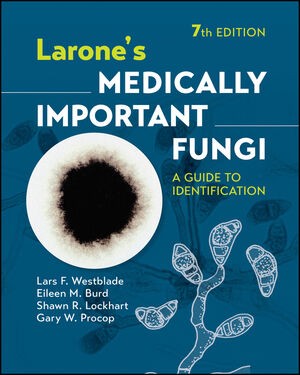 Larone`s Medically Important Fungi: A Guide to Identification, 7th