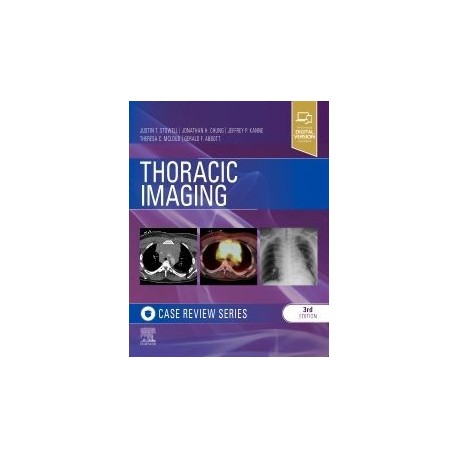 Thoracic Imaging: Case Review, 3rd Edition