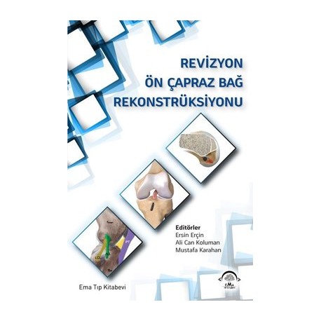 Revizyon Ön Çapraz Bağ Rekonstrüksiyonu Revizyon Ön Çapraz Bağ Rekonstrüksiyonu