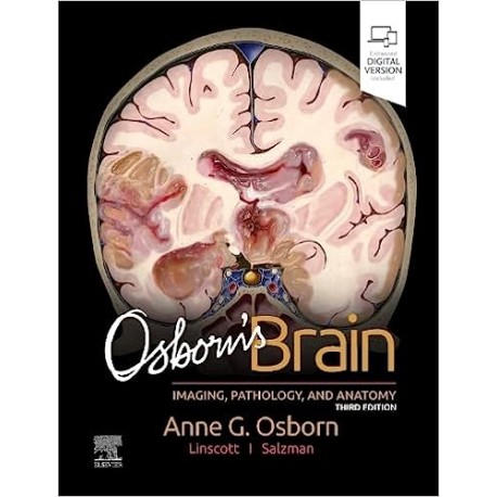 Osborn`s Brain, 3rd Edition