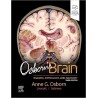 Osborn`s Brain, 3rd Edition