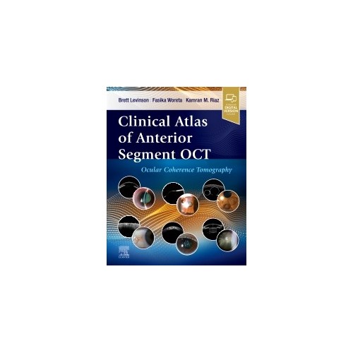 Clinical atlas of anterior segment oct ocular coherence tomography