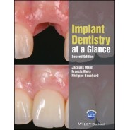 Implant Dentistry at a Glance, 2nd Edition