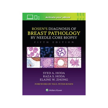 Rosen`s Diagnosis of Breast Pathology by Needle Core Biopsy,5rd Edition