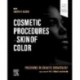 Procedures in Cosmetic Dermatology: Cosmetic Procedures in Skin of Color