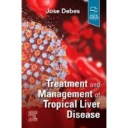 Treatment and Management of Tropical Liver Disease