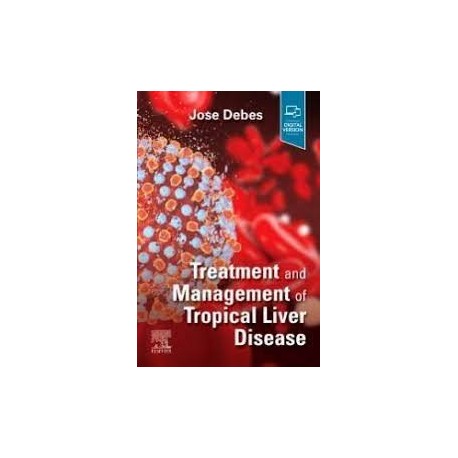 Treatment and Management of Tropical Liver Disease