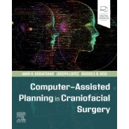 Computer-Assisted Planning in Craniofacial Surgery