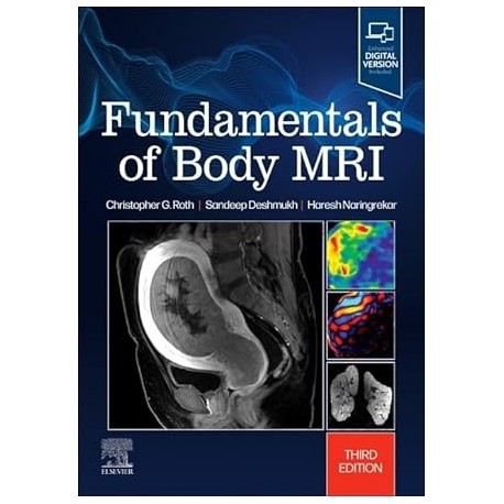 Fundamentals of Body MRI, 3rd Edition