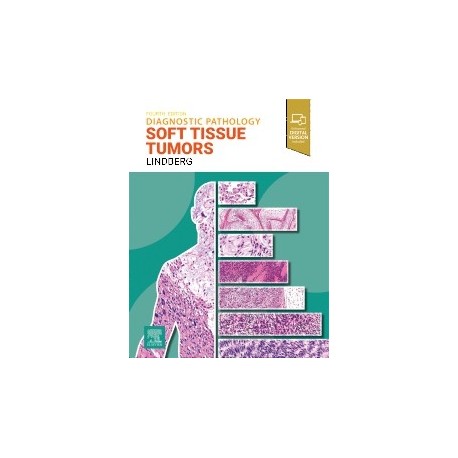 Diagnostic Pathology: Soft Tissue Tumors, 4th Edition