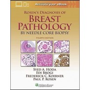 Rosen`s Diagnosis of Breast Pathology 