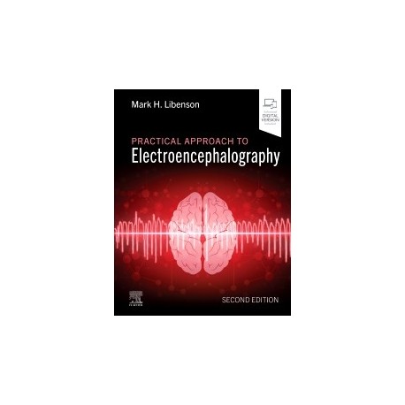 Practical Approach to Electroencephalography, 2nd Edition