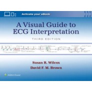 A Visual Guide to ECG Interpretation