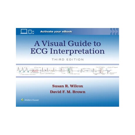 A Visual Guide to ECG Interpretation A Visual Guide to ECG Interpretation