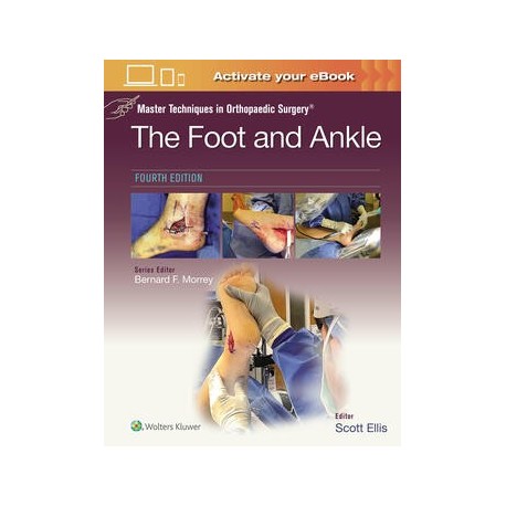 Master Techniques in Orthopaedic Surgery: The Foot and Ankle: Print + eBook with Multimedia,4Edition
