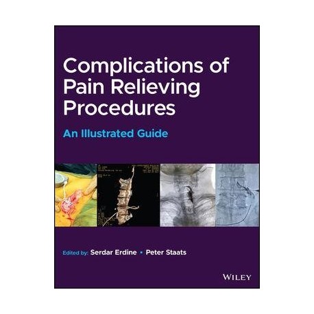 Complications of Pain-Relieving Procedures: An Illustrated Guide