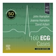 160 ECG Cases, 6th Edition