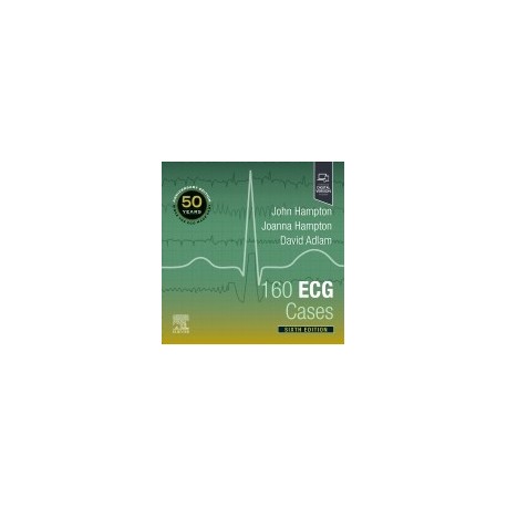 160 ECG Cases, 6th Edition
