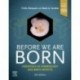 Before We Are Born Essentials of Embryology and Birth Defects, 11th Edition