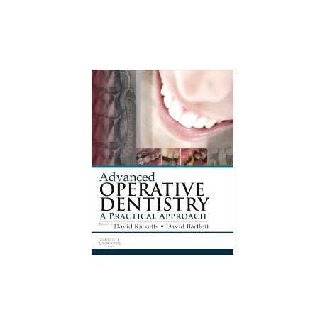 Advanced Operative Dentistry A Practical Approach