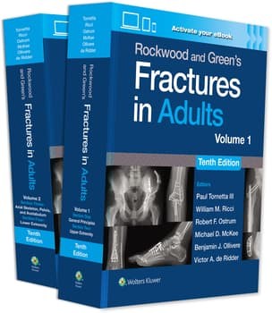 Rockwood and Green`s Fractures in Adults: Print + eBook with