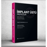 İmplant Üstü Protezler Sabit İmplant Üstü Restorasyonlar için Protokol ve Teknikler
