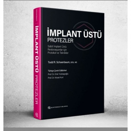 İmplant Üstü Protezler Sabit İmplant Üstü Restorasyonlar için Protokol ve Teknikler