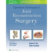 Operative Techniques in Joint Reconstruction Surgery, 3th Edition