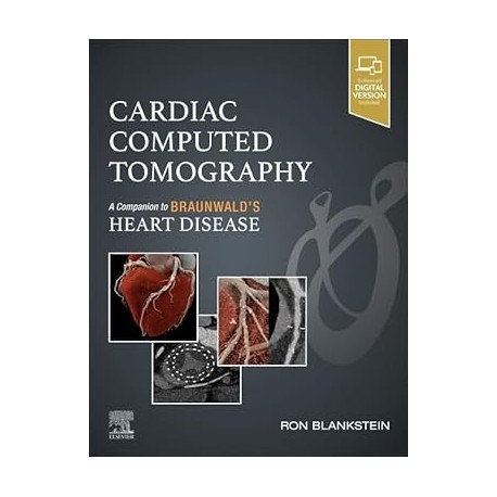 Cardiac Computed Tomography A Companion to Braunwald's Heart Disease