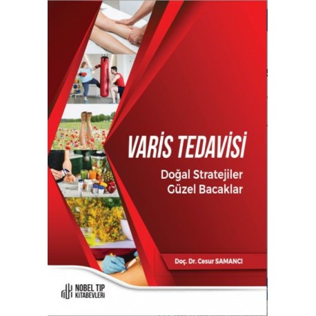 Varis Tedavisi Doğal Stratejiler,Güzel Bacaklar