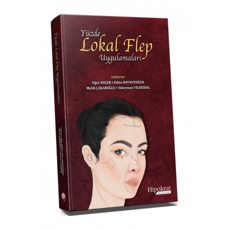Yüzde Lokal Flep Uygulamaları
