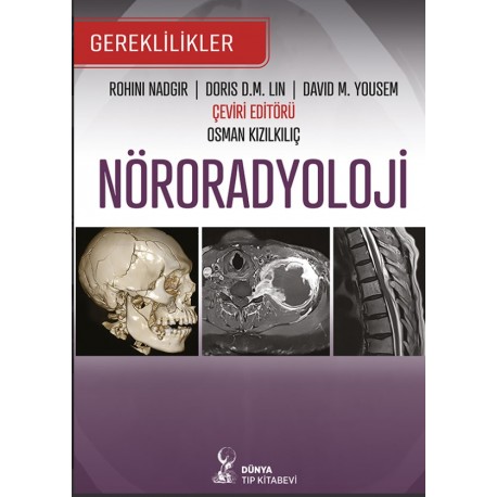 Nöroradyoloji Gereklilikler