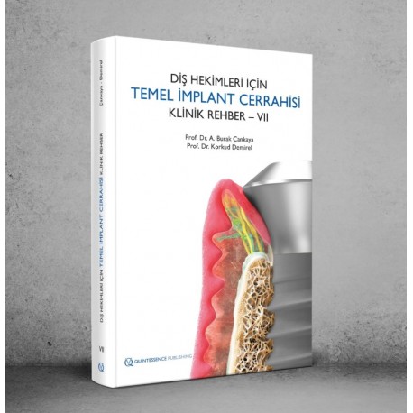 Diş Hekimleri İçin Temel İmplant Cerrahisi Klinik Rehber – VII