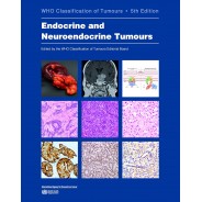 Endocrine and Neuroendocrine Tumours WHO Classification of Tumours, 5th