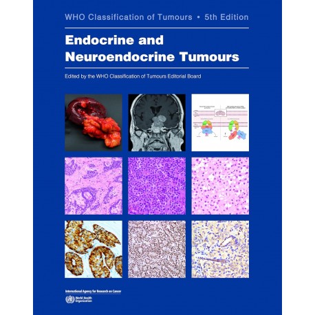 Endocrine and Neuroendocrine Tumours WHO Classification of Tumours, 5th