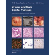Urinary and Male Genital Tumours WHO Classification of Tumours, 5th