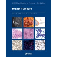 Breast Tumours WHO Classification of Tumours, 5th
