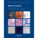 Breast Tumours WHO Classification of Tumours, 5th